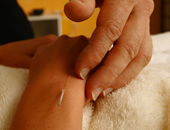 Acupunture treatments