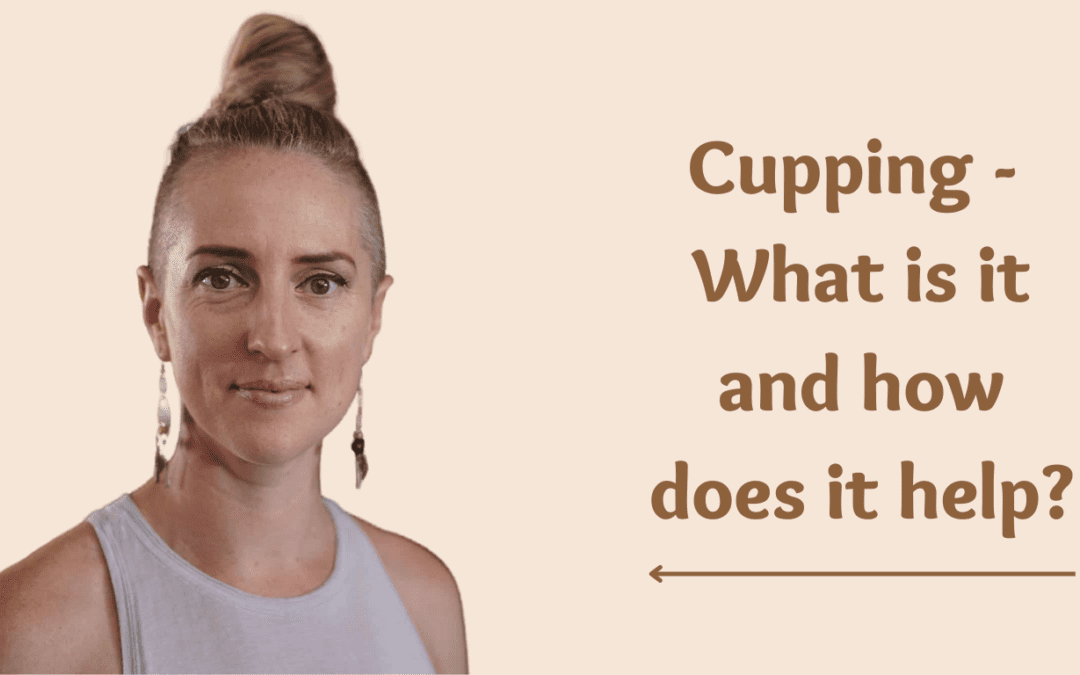 Cupping – What is it and how does it help?