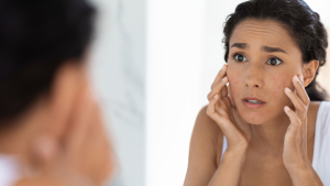 bell's palsy acupuncture 